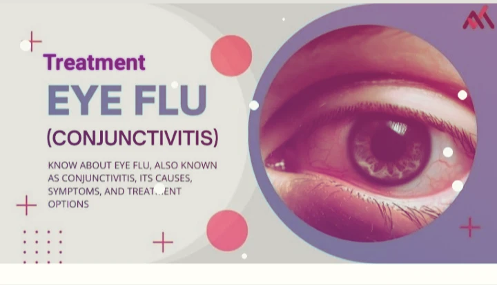 Eye Flu Conjunctivitis